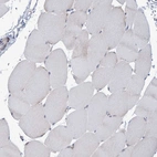 Immunohistochemical staining of human skeletal muscle shows no positivity in myocytes as expected.