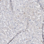 Immunohistochemical staining of human liver shows no positivity in hepatocytes as expected.