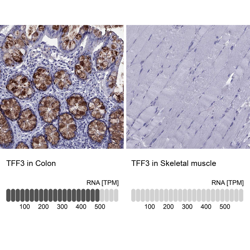 Anti-TFF3 Antibody
