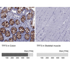Anti-TFF3 Antibody