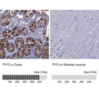 Anti-TFF3 Antibody