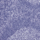 Immunohistochemical staining of human tonsil shows no positivity in lymphoid cells as expected.
