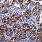 Immunohistochemical staining of human colon shows moderate to strong positivity in mucus in glandular cells.