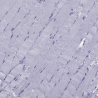 Immunohistochemical staining of human skeletal muscle shows no positivity in myocytes as expected.