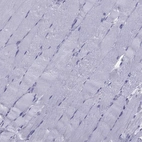 Immunohistochemical staining of human skeletal muscle shows no positivity in myocytes as expected.