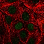 Immunofluorescent staining of human cell line MCF7 shows localization to nucleus & nucleoli.