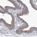 Anti-TTC21B Antibody