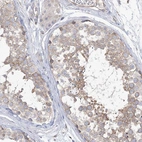Immunohistochemical staining of human testis shows weak cytoplasmic/membranous positivity in cells in seminiferous ducts.