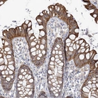 Immunohistochemical staining of human colon shows strong membranous positivity in glandular cells.