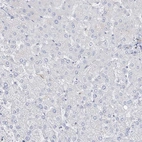 Immunohistochemical staining of human liver shows no positivity in hepatocytes as expected.
