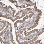 Anti-HACL1 Antibody