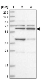 Lane 1: Marker [kDa] 230, 130, 95, 72, 56, 36, 28, 17, 11_br/_Lane 2: Human cell line RT-4_br/_Lane 3: Human cell line U-251MG sp