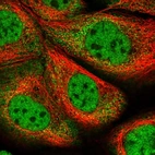 Immunofluorescent staining of human cell line A-431 shows localization to nucleoplasm & cytosol.
