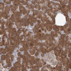 Anti-GMPPA Antibody