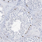Anti-SLC35A5 Antibody