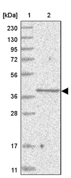 Anti-SLC35A5 Antibody
