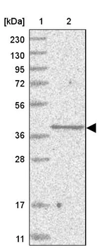 Lane 1: Marker [kDa] 230, 130, 95, 72, 56, 36, 28, 17, 11_br/_Lane 2: Human cell line RT-4
