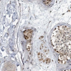 Anti-KIF15 Antibody