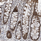 Immunohistochemical staining of human rectum shows moderate cytoplasmic-membranous positivity in glandular cells.