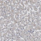 Immunohistochemical staining of human liver shows no positivity in hepatocytes as expected.