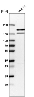 Western blot analysis in human cell line MOLT-4.