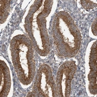 Immunohistochemical staining of human endometrium shows moderate cytoplasmic positivity in glandular cells.