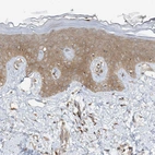 Immunohistochemical staining of human squamous epithelia shows moderate cytoplasmic positivity in squamous epithelial cells.