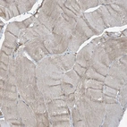 Immunohistochemical staining of human skeletal muscle shows very weak positivity in myocytes.