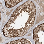Immunohistochemical staining of human testis shows moderate cytoplasmic positivity in cells in seminiferous ducts.