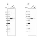 Western blot analysis using Anti-STAM2 antibody HPA035528 (A) shows similar pattern to independent antibody HPA035529 (B).