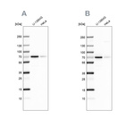 Western blot analysis using Anti-STAM2 antibody HPA035529 (A) shows similar pattern to independent antibody HPA035528 (B).