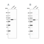 Western blot analysis using Anti-STAM2 antibody HPA035529 (A) shows similar pattern to independent antibody HPA035528 (B).