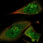 Immunofluorescent staining of human cell line U-251 MG shows localization to nucleoplasm, cytosol & vesicles.