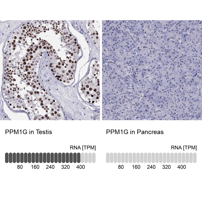 Anti-PPM1G Antibody