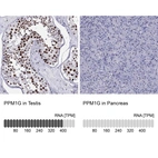 Anti-PPM1G Antibody