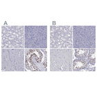 Immunohistochemical staining of human kidney, pancreas, skeletal muscle and testis using Anti-PPM1G antibody HPA035530 (A) shows similar protein distribution across tissues to independent antibody HPA035531 (B).