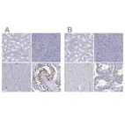 Immunohistochemical staining of human kidney, pancreas, skeletal muscle and testis using Anti-PPM1G antibody HPA035530 (A) shows similar protein distribution across tissues to independent antibody HPA035531 (B).