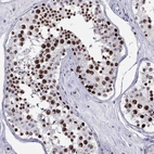 Immunohistochemical staining of human testis shows strong nuclear positivity in cells in seminiferous ducts.