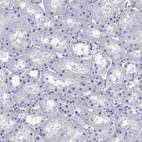 Immunohistochemical staining of human kidney shows no positivity in cells in tubules as expected.