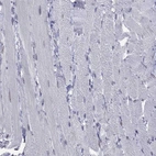 Immunohistochemical staining of human skeletal muscle shows no positivity in myocytes as expected.