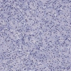 Immunohistochemical staining of human pancreas shows no positivity in exocrine glandular cells as expected.
