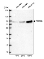 Western blot analysis in U2OS cells transfected with control siRNA, target specific siRNA probe #1 and #2, using Anti-PPM1G antibody. Remaining relative intensity is presented.