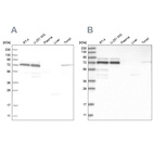 Western blot analysis using Anti-PPM1G antibody HPA035530 (A) shows similar pattern to independent antibody HPA035531 (B).