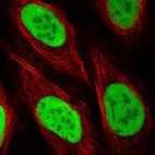 Immunofluorescent staining of human cell line U-2 OS shows localization to nucleoplasm.