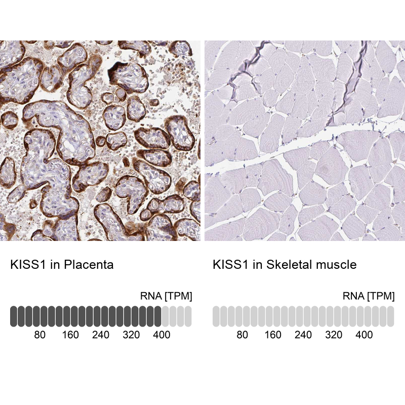 Anti-KISS1 Antibody