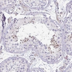 Immunohistochemical staining of human testis shows moderate perinuclear positivity in a subset of cells in seminiferous ducts.