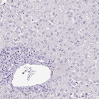 Immunohistochemical staining of human liver shows no positivity in hepatocytes as expected.