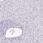 Immunohistochemical staining of human liver shows no positivity in hepatocytes as expected.