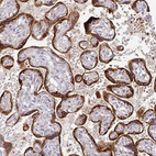 Immunohistochemical staining of human placenta shows strong cytoplasmic positivity in trophoblastic cells.