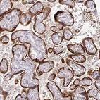 Immunohistochemical staining of human placenta shows strong cytoplasmic positivity in trophoblastic cells.